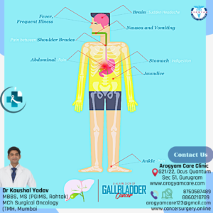 signs and symptoms of gallbladder cancer