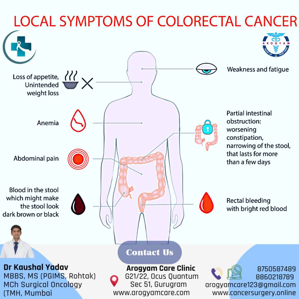 Symptoms of colorectal cancer. How to identify rectum cancer