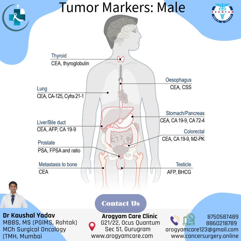Blood test for cancer detect: Tumor Markers for cancer detection male.