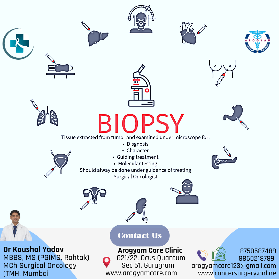 Biopsy test for cancer: All you need to know about.