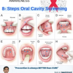 Oral Cancer Screening Self Examination Guide How to examine mouth