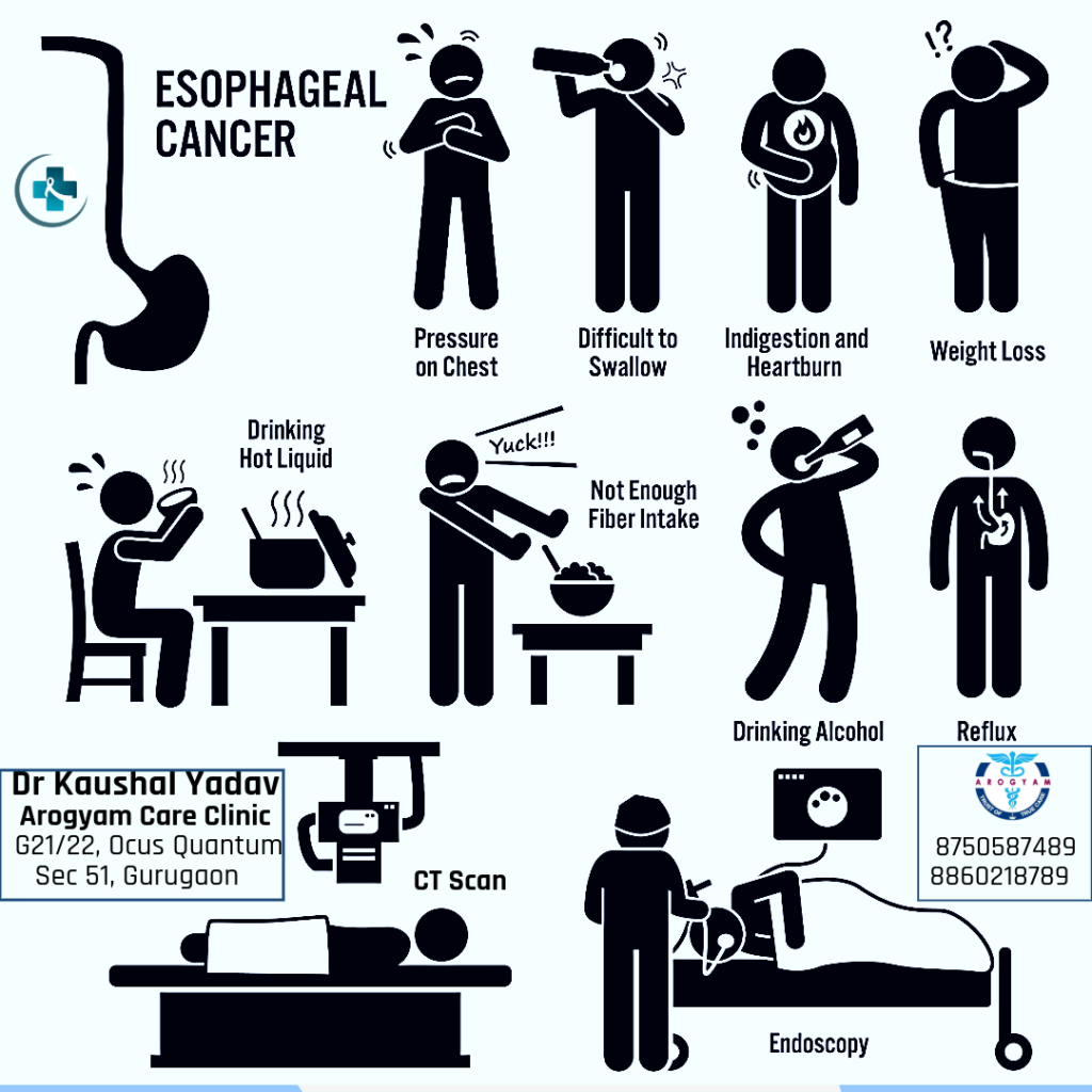 causes of esophagus cancer