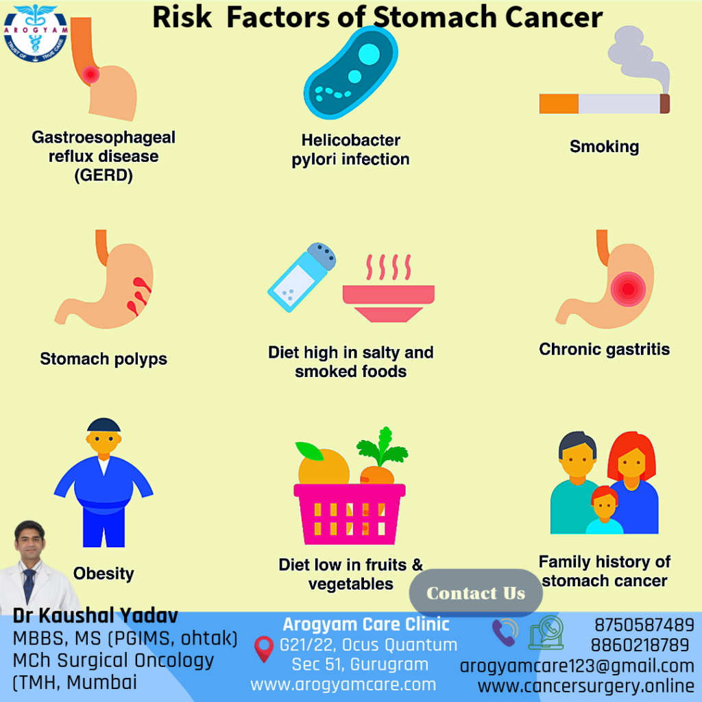 Causes and risk factors of stomach cancer