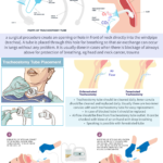 How to do tracheostomy suction tracheostomy care