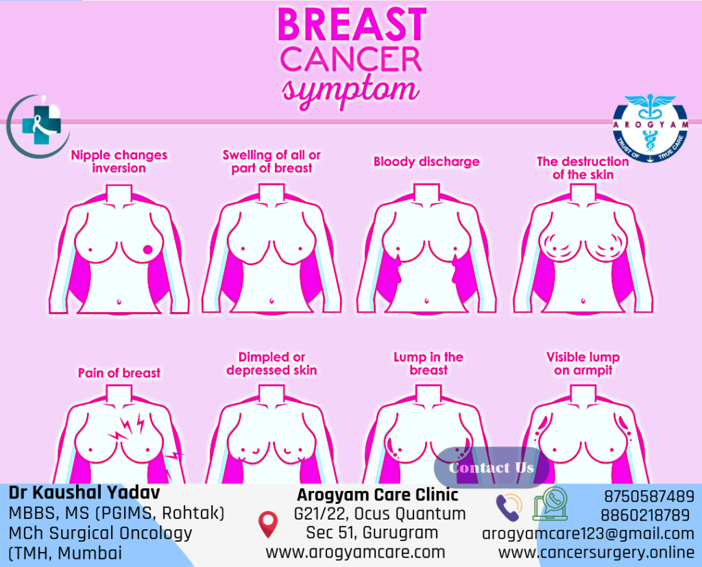 Early signs of Breast cancer symptoms