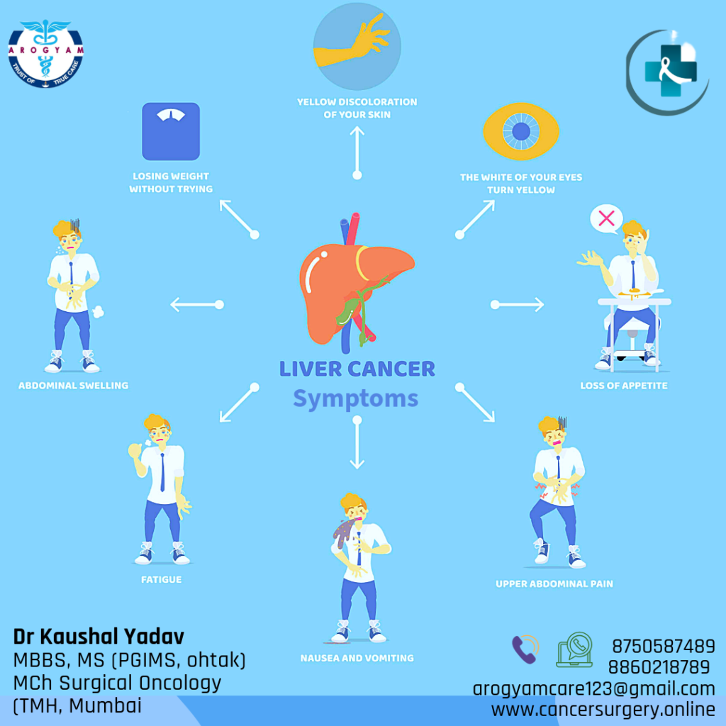 Liver cancer symptoms